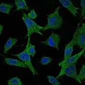 Anti-MEK6 antibody [3H12C8] used in Immunocytochemistry/ Immunofluorescence (ICC/IF). GTX60396