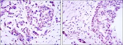 Anti-CRTC3 antibody [5G9] used in IHC (Paraffin sections) (IHC-P). GTX60400
