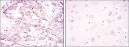 Anti-AMPK alpha 1 antibody [2B7] used in IHC (Paraffin sections) (IHC-P). GTX60403