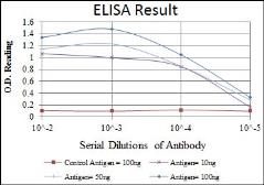 Anti-ATM antibody [5C5] used in ELISA (ELISA). GTX60404