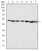 Anti-p63 antibody [4E5] used in Western Blot (WB). GTX60407