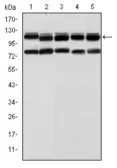 Anti-BMPR2 antibody [1F12] used in Western Blot (WB). GTX60414