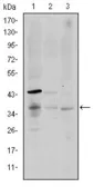 Anti-CD1a antibody [6H3] used in Western Blot (WB). GTX60416