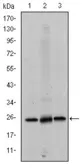 Anti-eIF4E antibody [5D11] used in Western Blot (WB). GTX60420