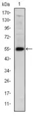 Anti-LHX2 antibody [6G2] used in Western Blot (WB). GTX60422