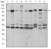 Anti-FUK antibody [6E2] used in Western Blot (WB). GTX60438