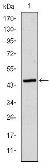 Anti-Apolipoprotein B antibody [6G6] used in Western Blot (WB). GTX60445
