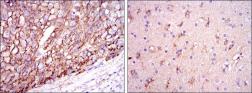 Anti-Apolipoprotein E antibody [1H4] used in IHC (Paraffin sections) (IHC-P). GTX60446