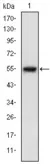 Anti-ASK1 antibody [2E4] used in Western Blot (WB). GTX60456