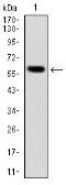 Anti-BLNK antibody [5G9] used in Western Blot (WB). GTX60463