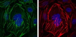 Anti-alpha Smooth Muscle Actin antibody [4A4] used in Immunocytochemistry/ Immunofluorescence (ICC/IF). GTX60466