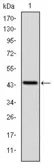 Anti-LIMS1 antibody [5G7] used in Western Blot (WB). GTX60472