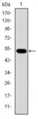Anti-Glucokinase antibody [4G6] used in Western Blot (WB). GTX60474
