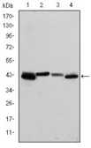 Anti-Cytokeratin 19 antibody [4E8] used in Western Blot (WB). GTX60480
