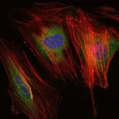 Anti-MMP9 antibody [5G3] used in Immunocytochemistry/ Immunofluorescence (ICC/IF). GTX60482