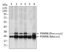 Anti-PSMB8 antibody [1A5] used in Western Blot (WB). GTX60486