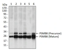 Anti-PSMB8 antibody [1A5] used in Western Blot (WB). GTX60486