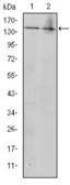Anti-c-Kit antibody [1C5] used in Western Blot (WB). GTX60490