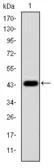 Anti-ERK1 antibody [1E5] used in Western Blot (WB). GTX60492