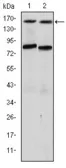 Anti-AIB1 antibody [5H3] used in Western Blot (WB). GTX60494