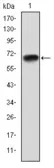 Anti-PGC1 alpha antibody [1G8] used in Western Blot (WB). GTX60496