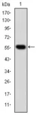 Anti-TCP1 beta antibody [5B5F5] used in Western Blot (WB). GTX60497