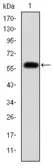 Anti-Fibrinogen gamma antibody [5A6] used in Western Blot (WB). GTX60498