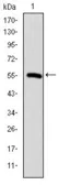 Anti-TCP1 beta antibody [5B5C4] used in Western Blot (WB). GTX60505