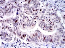Anti-KIF22 antibody [5F3] used in IHC (Paraffin sections) (IHC-P). GTX60506