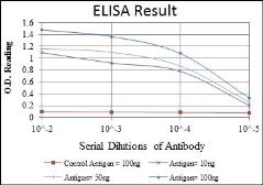 Anti-Troponin I fast skeletal muscle antibody [2F12A11] used in ELISA (ELISA). GTX60507