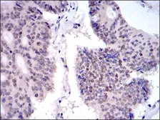 Anti-KIF22 antibody [1E3] used in IHC (Paraffin sections) (IHC-P). GTX60508