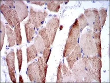 Anti-Troponin I fast skeletal muscle antibody [2F12A8] used in IHC (Paraffin sections) (IHC-P). GTX60509