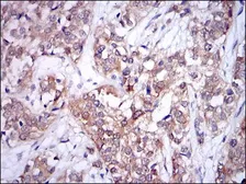 Anti-UBE2I antibody [1B10] used in IHC (Paraffin sections) (IHC-P). GTX60512