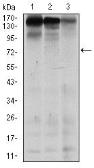 Anti-MSH6 antibody [5B11] used in Western Blot (WB). GTX60514
