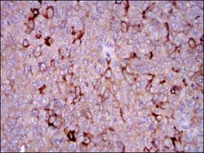 Anti-G6PD antibody [5E12] used in IHC (Paraffin sections) (IHC-P). GTX60515