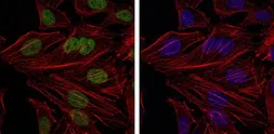 Anti-Bmi1 antibody [3E3] used in Immunocytochemistry/ Immunofluorescence (ICC/IF). GTX60516
