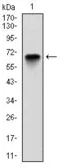 Anti-G6PD antibody [2H7] used in Western Blot (WB). GTX60518