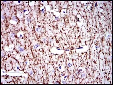 Anti-Myelin basic protein antibody [2H9] used in IHC (Paraffin sections) (IHC-P). GTX60519