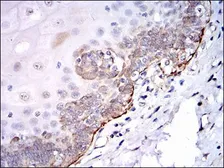 Anti-Src antibody [1F11] used in IHC (Paraffin sections) (IHC-P). GTX60521