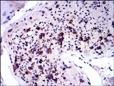 Anti-NQO1 antibody [4D12] used in IHC (Paraffin sections) (IHC-P). GTX60523