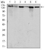 Anti-MSH6 antibody [3E1] used in Western Blot (WB). GTX60530