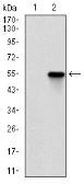 Anti-ROCK1 antibody [1H4] used in Western Blot (WB). GTX60535