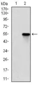 Anti-ROCK1 antibody [1H4] used in Western Blot (WB). GTX60535