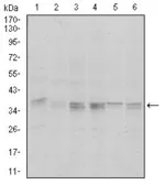 Anti-PPP1A antibody [5E9] used in Western Blot (WB). GTX60538