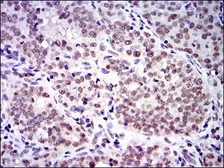 Anti-SKP1 antibody [1H9] used in IHC (Paraffin sections) (IHC-P). GTX60547