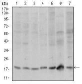 Anti-SKP1 antibody [1H9] used in Western Blot (WB). GTX60547