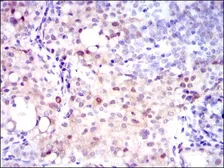 Anti-ASS1 antibody [2C10] used in IHC (Paraffin sections) (IHC-P). GTX60552