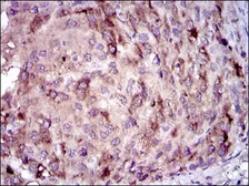 Anti-C Reactive Protein antibody [1G1] used in IHC (Paraffin sections) (IHC-P). GTX60566