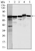 Anti-Moesin antibody [2C12] used in Western Blot (WB). GTX60569