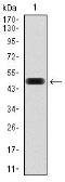 Anti-Fibronectin antibody [2F4] used in Western Blot (WB). GTX60570